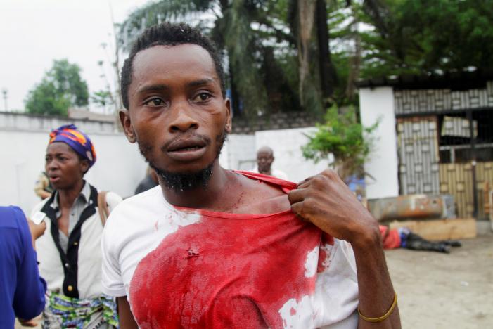 An injured Congolese opposition supporter walks outside the headquarters of the Union for Democracy and Social Progress (UDPS) during violent protests to press President Joseph Kabila to step down, in the Democratic Republic of Congo's capital Kinshas.