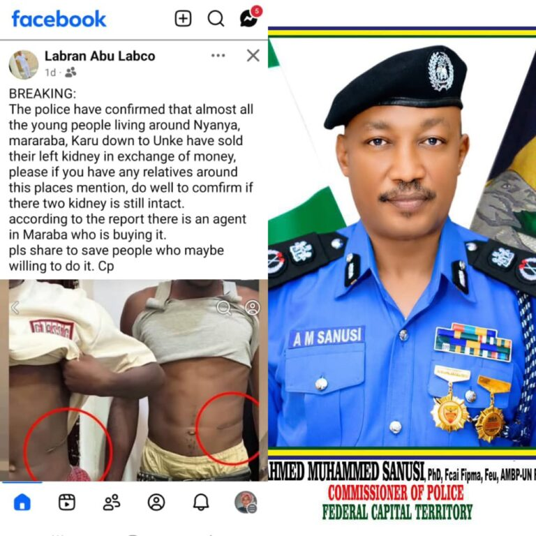 false a viral social media report alleging that young people around Nyanya have been selling their kidneys for money - THEWILL NEWS MEDIA false a viral social media report alleging that young people around Nyanya have been selling their kidneys for money