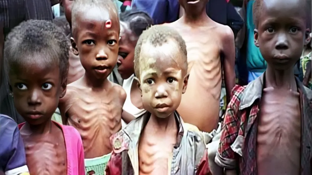 malnourished children - THEWILL NEWS MEDIA Group of severely malnourished children standing close together, looking at the camera with somber expressions.